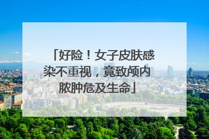 好险！女子皮肤感染不重视，竟致颅内脓肿危及生命