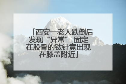 西安一老人跌倒后发现“异常” 固定在股骨的钛针竟出现在膝盖附近